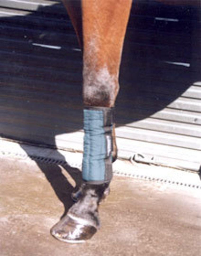 Chilla Tendon Wrap image 0