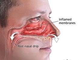 blocked nose