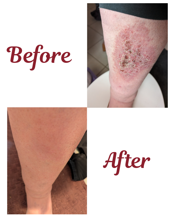 BeforeAfter Photos Small 1